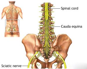 Red flags on back pain