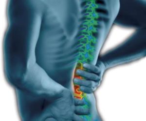 What is spinal stenosis