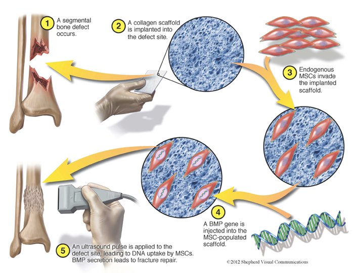 How can stem cells repair bone damage or injury?