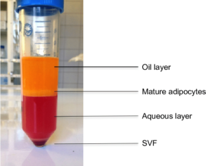 stromal vascular fraction