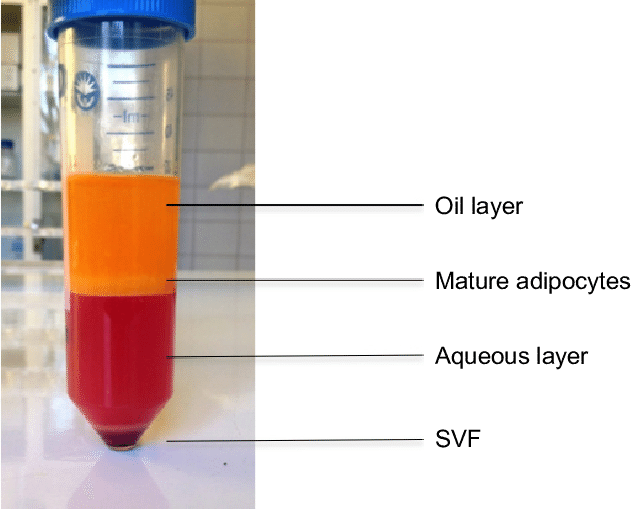 stromal vascular fraction