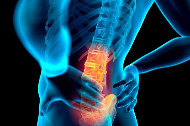 Most common causes of back pain