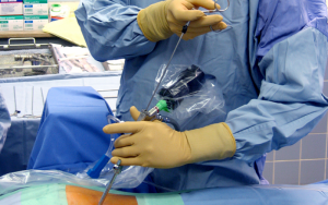 How is Endoscopic laser disc surgery performed