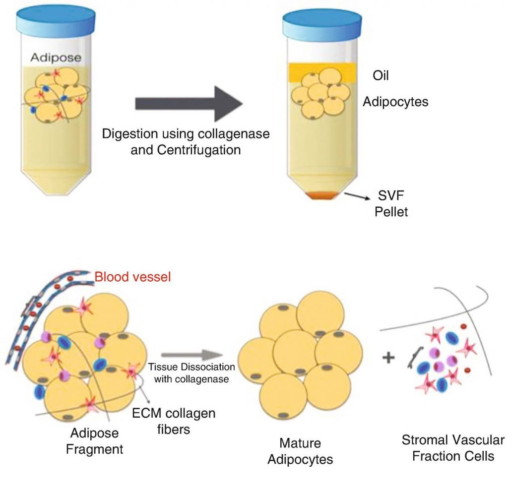 stromal vascular fraction