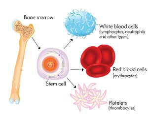 Stem cells transplant