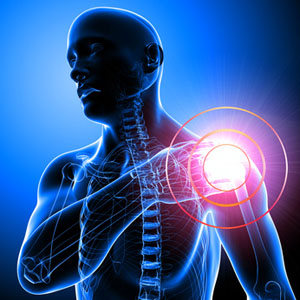 A Prospective Comparison of CT-Epidurogram Between Th1-Transforaminal Epidural Injection and Th1/2-Parasagittal Interlaminar Epidural Injection for Cervical Upper Limb Pain.